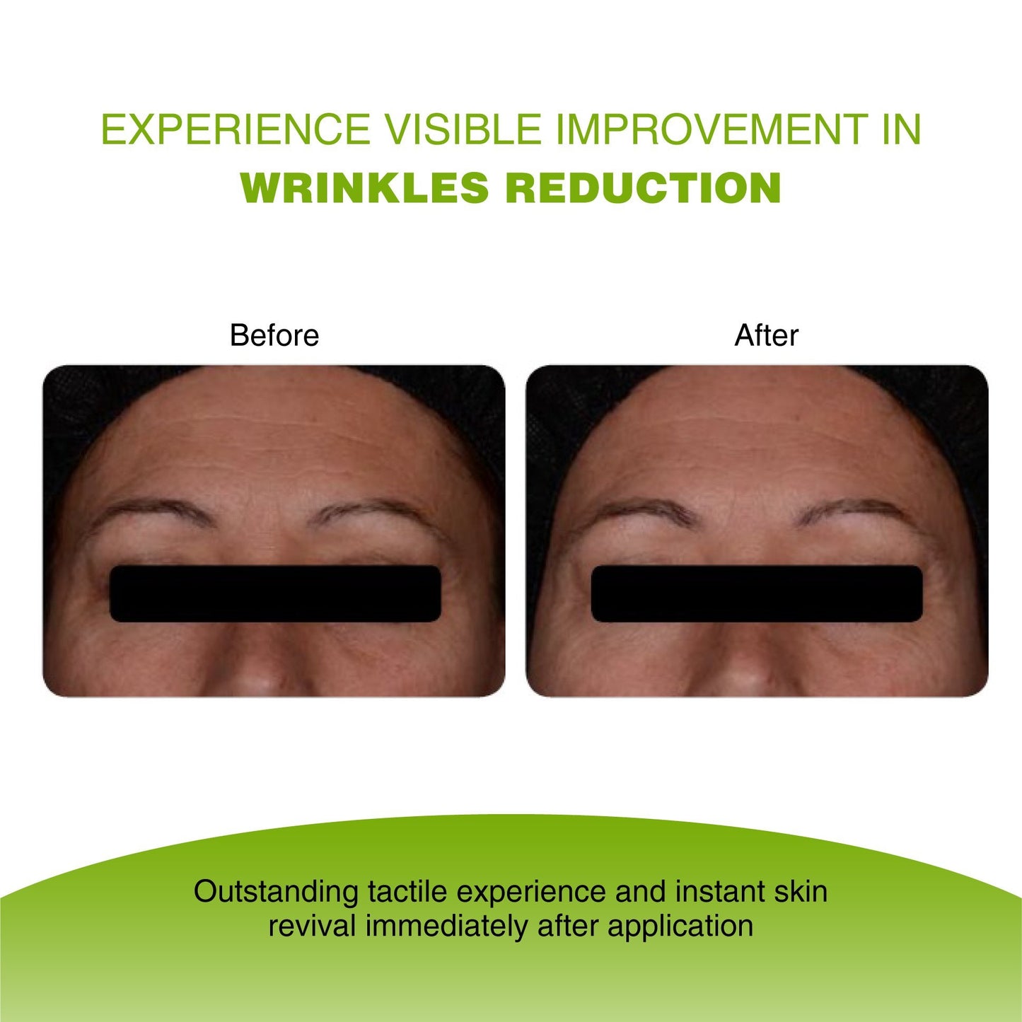 Vijuve Vitamin C Face Serum with Double Hyaluronic Acid and Collagen
